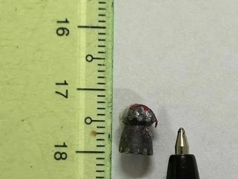 Cấp cứu người đàn ông bị "đạn lạc" xuyên ngực khi đi làm rẫy