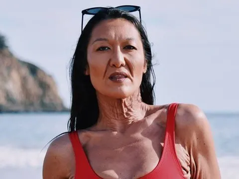 Người mẫu nội y 32 tuổi có làn da nhăn nheo như người già