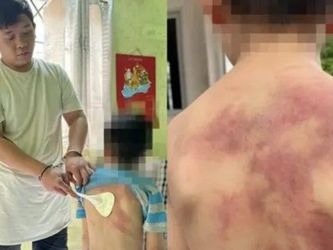 Đồng Nai: Tạm giữ cha ruột nhiều lần bạo hành con trai