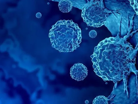 Mỹ: Tìm ra “công tắc” khiến tế bào ung thư tự hủy diệt