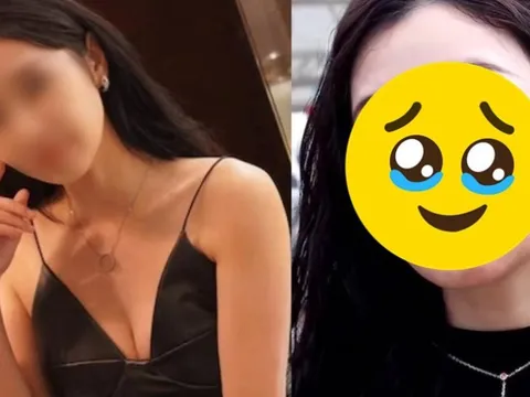 Sao nữ bị tàn phá nhan sắc nặng nề lúc quay phim mới, ai ngờ vẫn để mặt mộc ra đường vì 1 lý do
