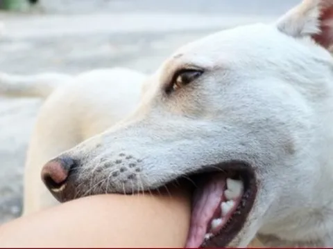 Theo bố đến chỗ làm, bé gái ở Hà Nội bị 4 con chó tấn công