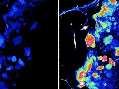 Phát hiện cơ quan xúc giác hoàn toàn mới ở người