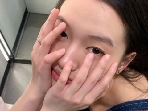 Gan khỏe hay không nhìn da là biết, thấy “đỏ, đen, vàng” này phải đi khám ngay