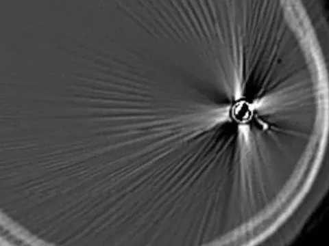 Đắk Lắk: Cứu sống cháu bé 12 tuổi bị đạn bắn vào đầu