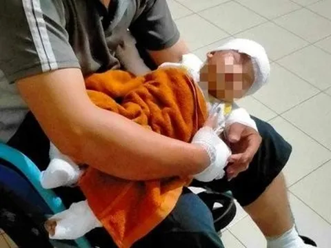 Bắt đối tượng ném bom xăng đòi nợ khiến bé trai 4 tháng tuổi bị bỏng