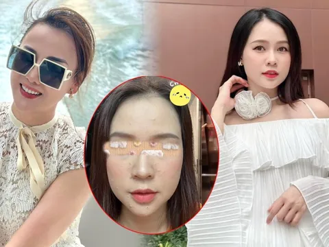 Mẹ bầu Vbiz tâm sự: Sam không dám ra đường vì mặt mụn, Phương Oanh ngỡ ngàng khi nhìn xuống bụng