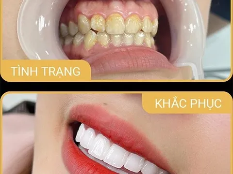 Nhiều phòng khám nha khoa bị xử phạt hàng trăm triệu đồng