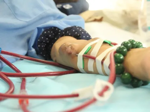 Nhiều người trẻ suy thận nhưng phát hiện rất muộn: 4 dấu hiệu cảnh báo ai cũng nên biết