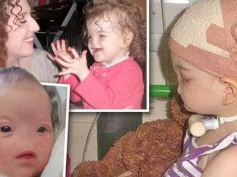 Người phụ nữ lão hóa nhanh như tụt dốc không phanh chỉ trong 20 ngày