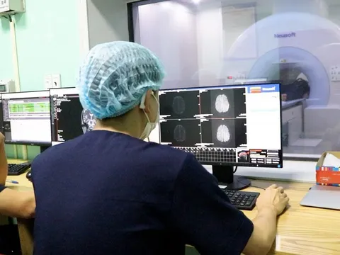 Đau nhức âm ỉ vùng trán, cô gái bất ngờ phát hiện khối u não nguy hiểm