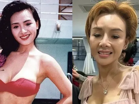 Biểu tượng gợi cảm Hong Kong Diệp Tử My chỉ còn 36 kg