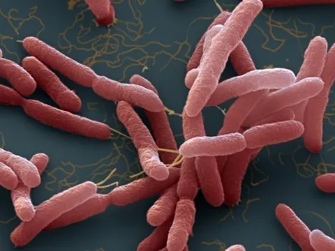 2 tháng gãy chân, người đàn ông bất ngờ phát hiện nhiễm khuẩn ăn thịt người