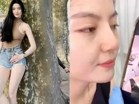 Vợ sắp cưới của Quang Hải công khai chỉnh sửa một điểm trên mặt nhằm có nét đẹp "ngọc nữ"