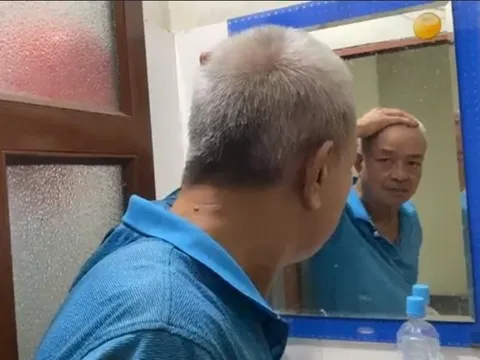 Vảy nến da đầu rụng lả tả khi trời lạnh, ông Thịnh đã kiểm soát nhờ Kim Miễn Khang