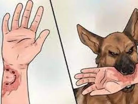 Bình Thuận: Một ca tử vong nghi do bệnh dại ở huyện Hàm Thuận Nam