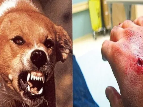 22 người tử vong do bệnh dại, Bộ Y tế khuyến cáo