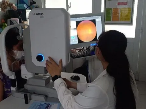 Tp.HCM: Tầm soát bệnh glôcôm miễn phí bằng công nghệ AI