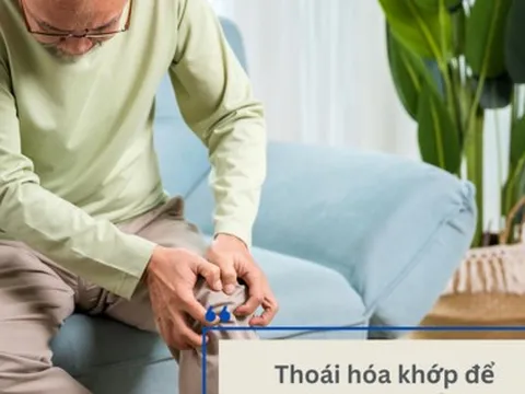 Biến chứng nặng của thoái hóa khớp và giải pháp cải thiện từ CốtWells