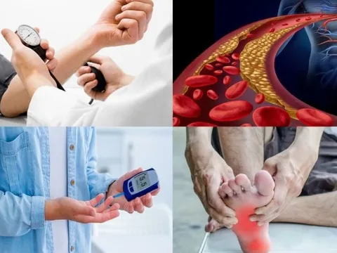 Những căn bệnh nam giới ngoài 50 tuổi sợ nhất và lời khuyên của bác sĩ