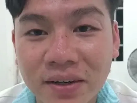 Tây Ninh: Phá thành công một vụ cướp giật tài sản