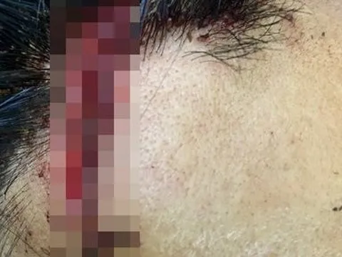 Đắk Nông: Nhóm đối tượng vào chốt tấn công lực lượng bảo vệ rừng