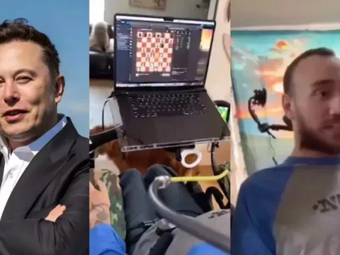 Elon Musk tìm ứng viên thứ 2 cấy chip não Neuralink, ai đủ điều kiện?