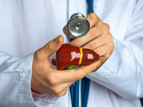 Ung thư gan đứng top đầu tử vong về bệnh lý ung thư ở nam giới