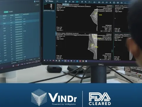 Đạt chuẩn FDA khắt khe, sản phẩm AI của VinBigdata rộng cửa kinh doanh trên toàn cầu