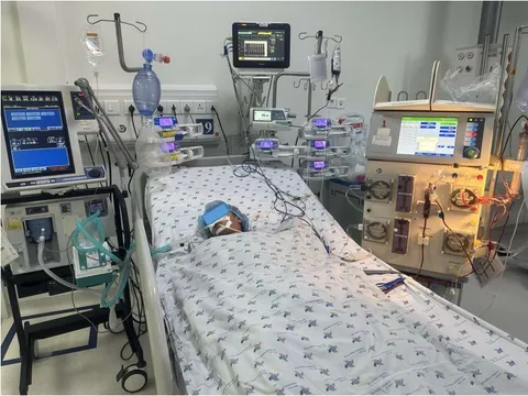 Bé gái sốc phản vệ, suy hô hấp nặng do bị ong vò vẽ đốt hơn 50 vết