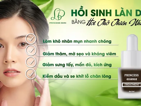 Trị mụn Princess có tốt không, có chứa coticoid không?