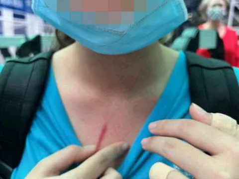 Phụ huynh trường quốc tế ở TP.HCM t.ố con bị bạn học "ra tay"